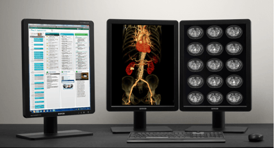 Optimizing Image Quality in the Radiologist’s Field of Vision